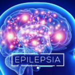 84925-el-70-de-los-pacientes-con-epilepsia-puede-tener-una-vida-plena-bajo-un-tratamiento-adecuado